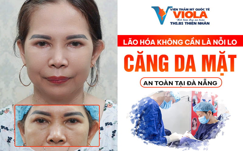 lao hoa khong con la noi lo voi cang da mat tai da nang