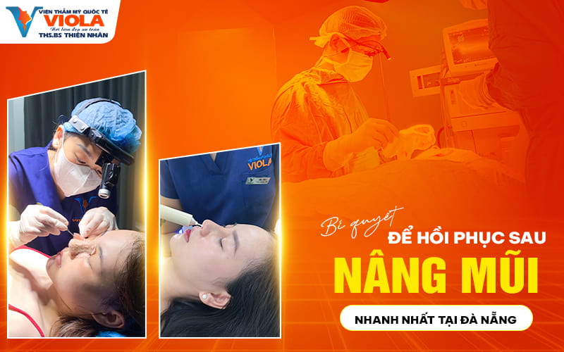 bi quyet de hoi phuc sau nang mui nhanh nhat tai da nang