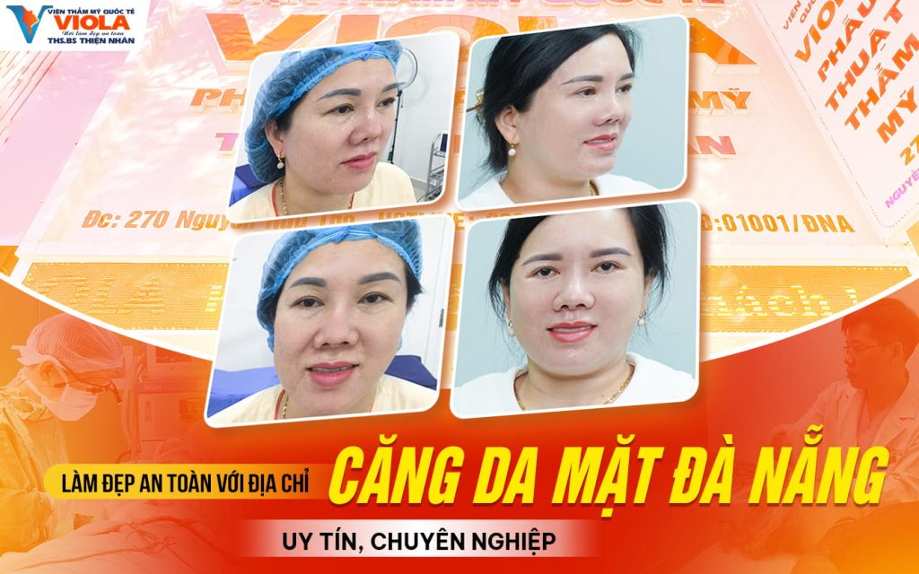 Làm đẹp an toàn với địa chỉ căng da mặt Đà Nẵng uy tín, chuyên nghiệp 1 lam dep an toan voi dia chi cang da mat da nang uy tin chuyen nghiep