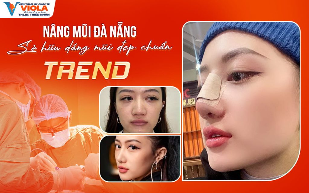 Nâng mũi Đà nẵng - Sở hữu dáng mũi đẹp chuẩn TREND 1 nang mui da nang so huu dang mui dep chuan trend