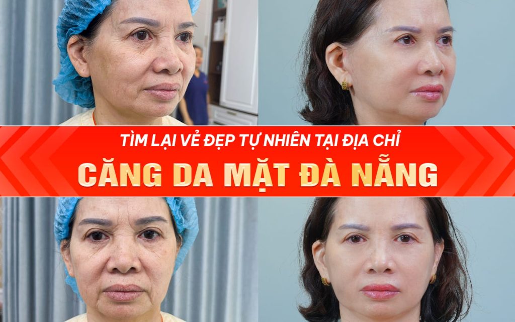Tìm lại vẻ đẹp tự nhiên tại địa chỉ căng da mặt Đà Nẵng uy tín 2026 1 tim lai ve dep tu nhien tai dia chi cang da mat da nang uy tin 2026