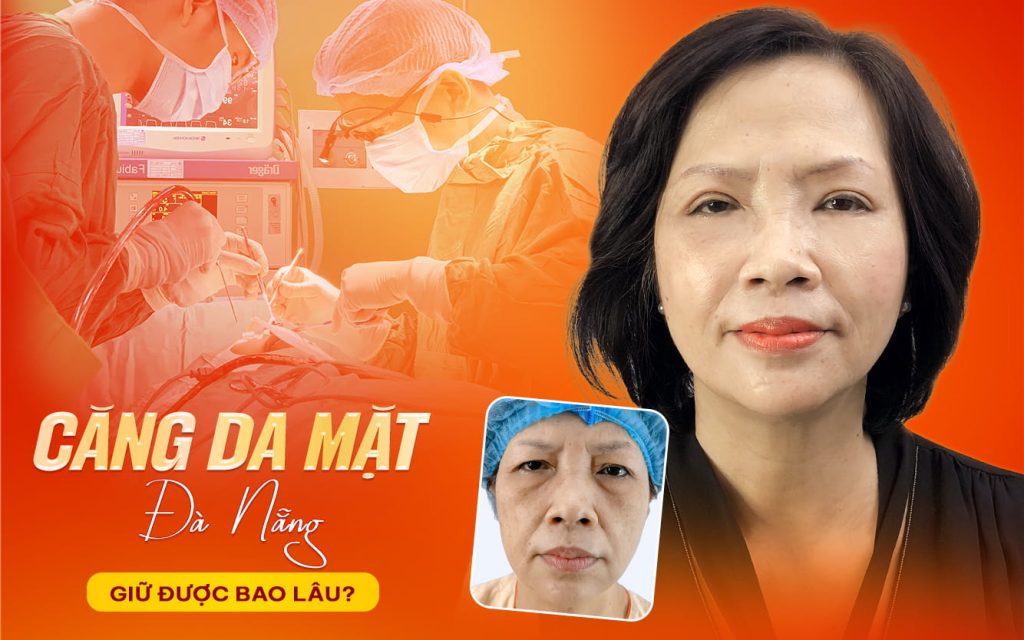 Căng da mặt Đà Nẵng giữ được bao lâu? Cách chăm sóc đúng chuẩn được hướng dẫn từ bác sĩ 1 cang da mat da nang giu duoc bao lau cach cham soc dung chuan duoc huong dan tu bac si
