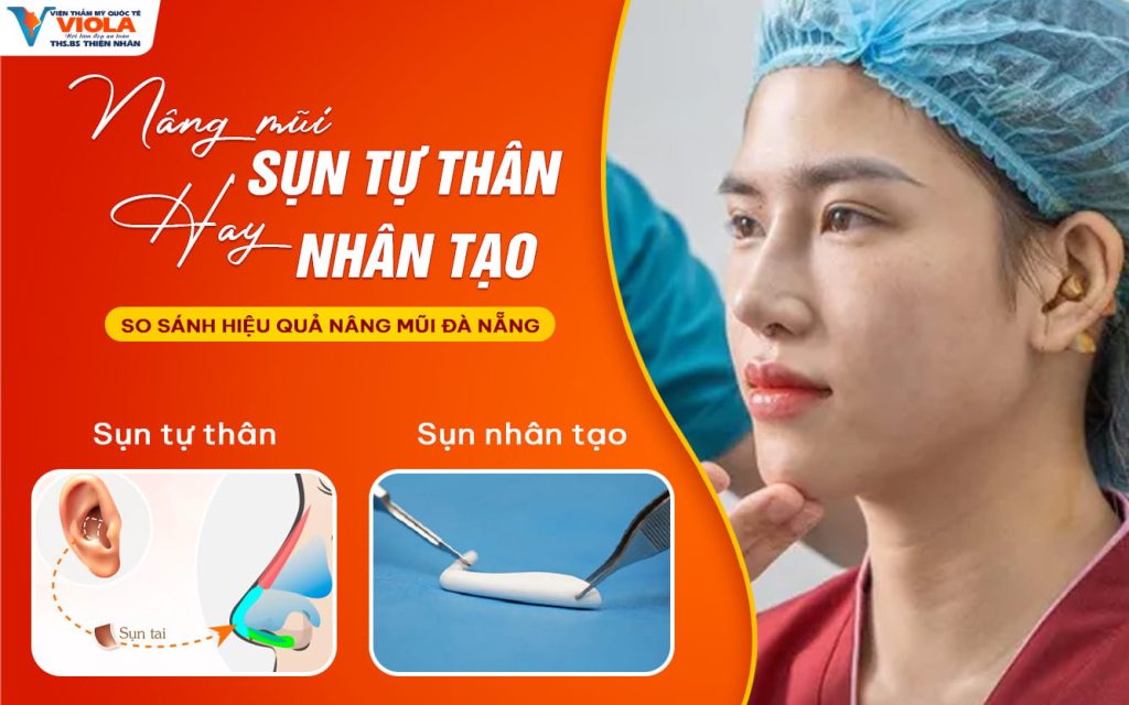 Nâng mũi bằng sụn tự thân hay nhân tạo? So sánh hiệu quả nâng mũi Đà Nẵng 1 nang mui bang sun tu than hay nhan tao so sanh hieu qua nang mui da nang