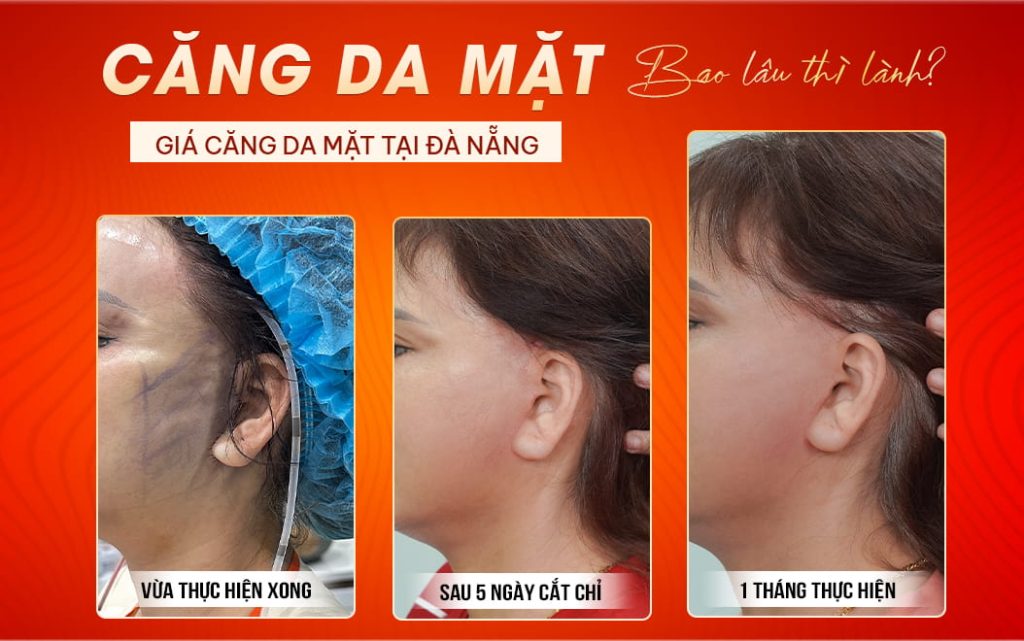 cang da mat bao lau thi lanh gia cang da mat tai da nang