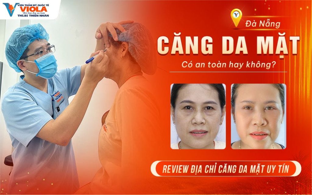 Căng da mặt Đà Nẵng có an toàn không? Review địa chỉ căng da mặt Đà Nẵng uy tín 1 cang da mat da nang co an toan khong review dia chi cang da mat da nang uy tin
