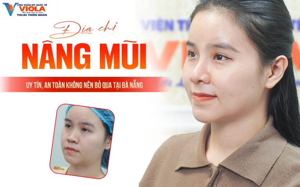 Địa chỉ nâng mũi uy tín, an toàn không nên bỏ qua tại Đà Nẵng 1 dia chi nang mui uy tin an toan khong nen bo qua tai da nang