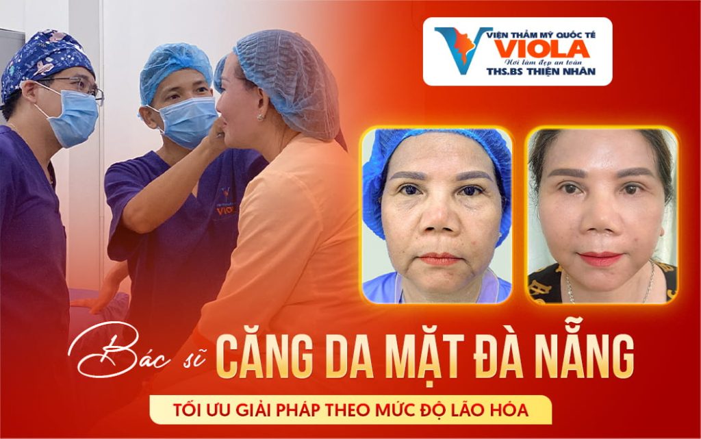 Bác sĩ căng da mặt Đà Nẵng - Tối ưu giải pháp theo mức độ lão hóa 1 bac si cang da mat da nang toi uu giai phap theo muc do lao hoa