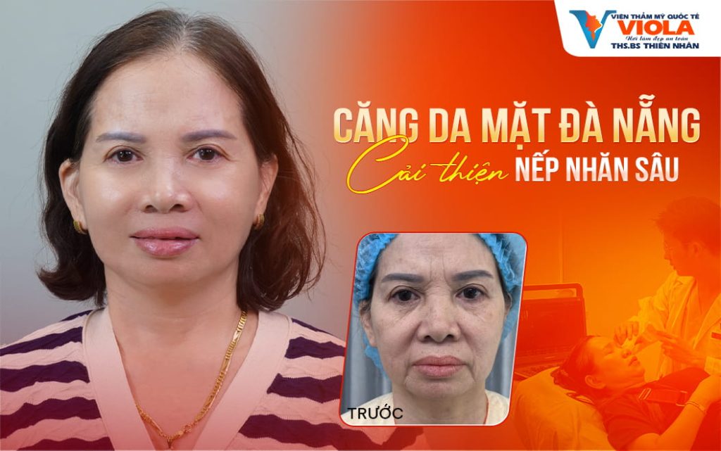 cang da mat da nang cai thien nep nhan sau