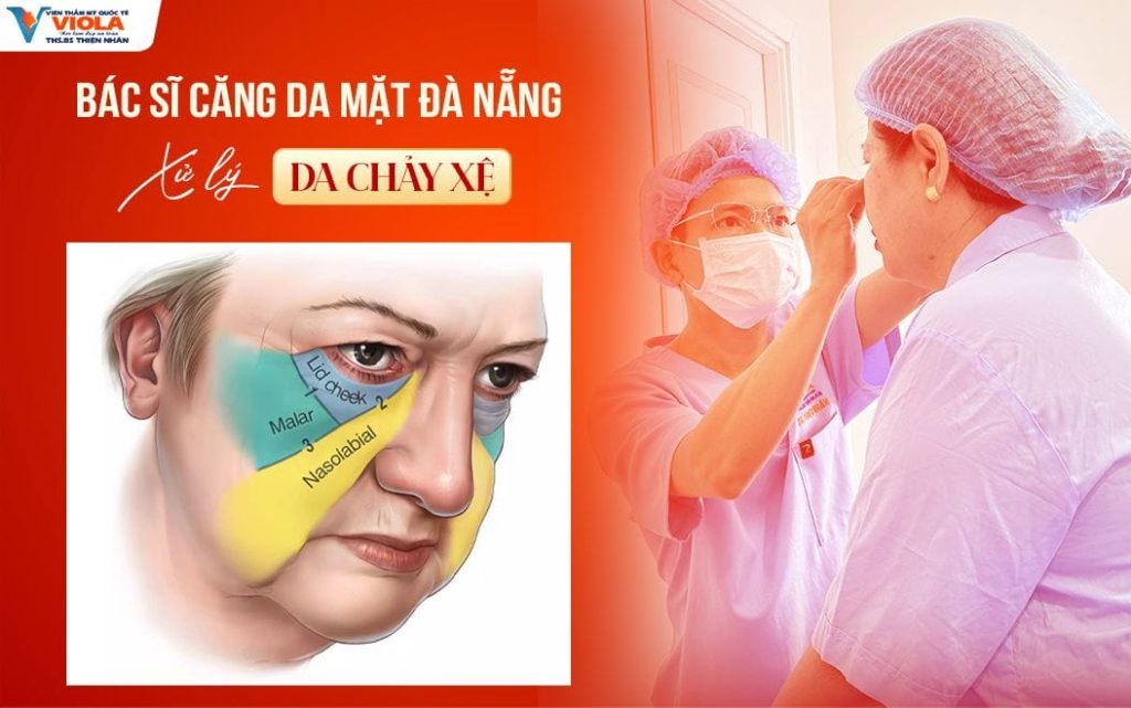 bac si cang da mat da nang xu ly chay xe