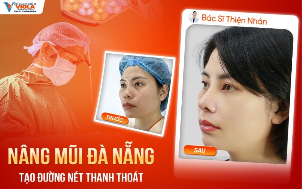 nang mui da nang tao duong net thanh thoat