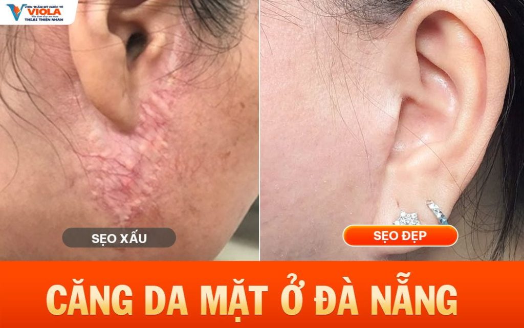 cang da mat o da nang tai sao co nguoi dep nguoi lai bi seo xau
