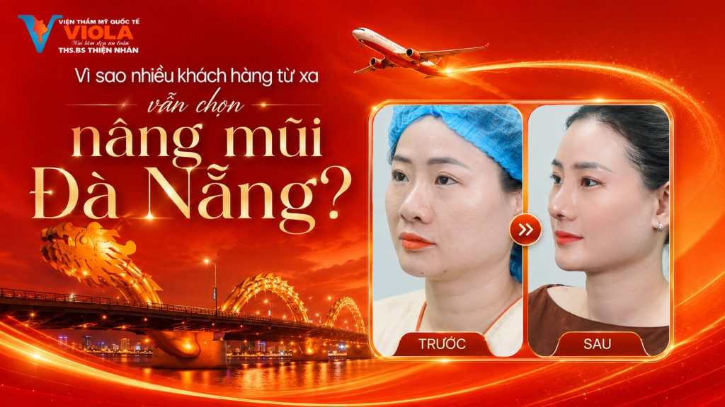Vì sao nhiều khách hàng từ xa vẫn chọn nâng mũi Đà Nẵng? 1 vi sao nhieu khach hang tu xa van chon nang mui da nang