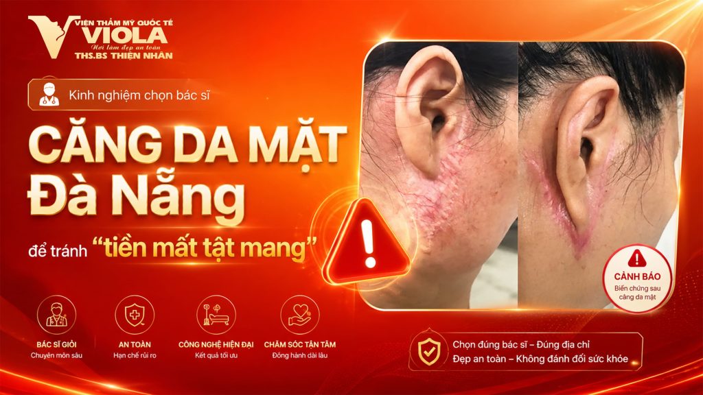 kinh nghiem chon bac si cang da mat da nang de tranh tien mat tat mang