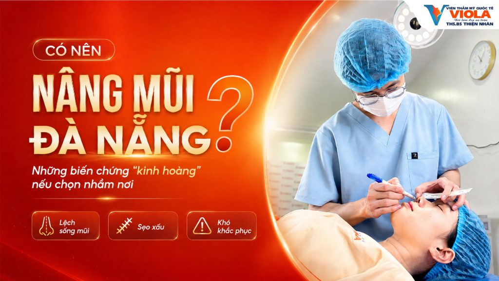 Có nên nâng mũi Đà Nẵng? những biến chứng "kinh hoàng" nếu chọn nhầm nơi 1 co nen nang mui da nang nhung bien chung kinh hoang neu chon nham noi
