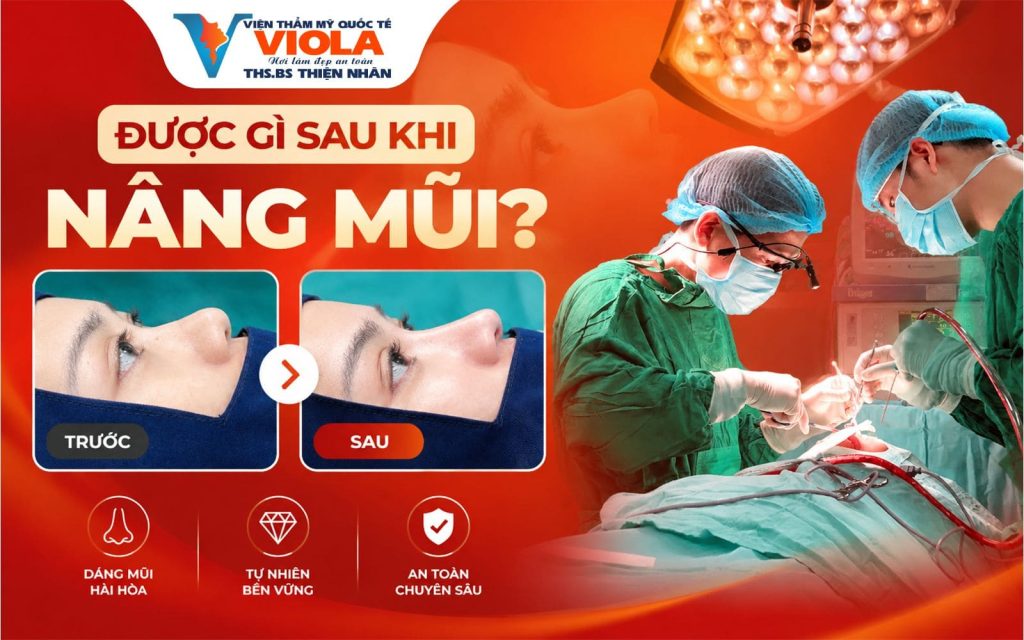 Nâng mũi Đà Nẵng tại Viola có uy tín không? Khách hàng được gì sau nâng mũi 3 duoc-gi-sau-nang-mui
