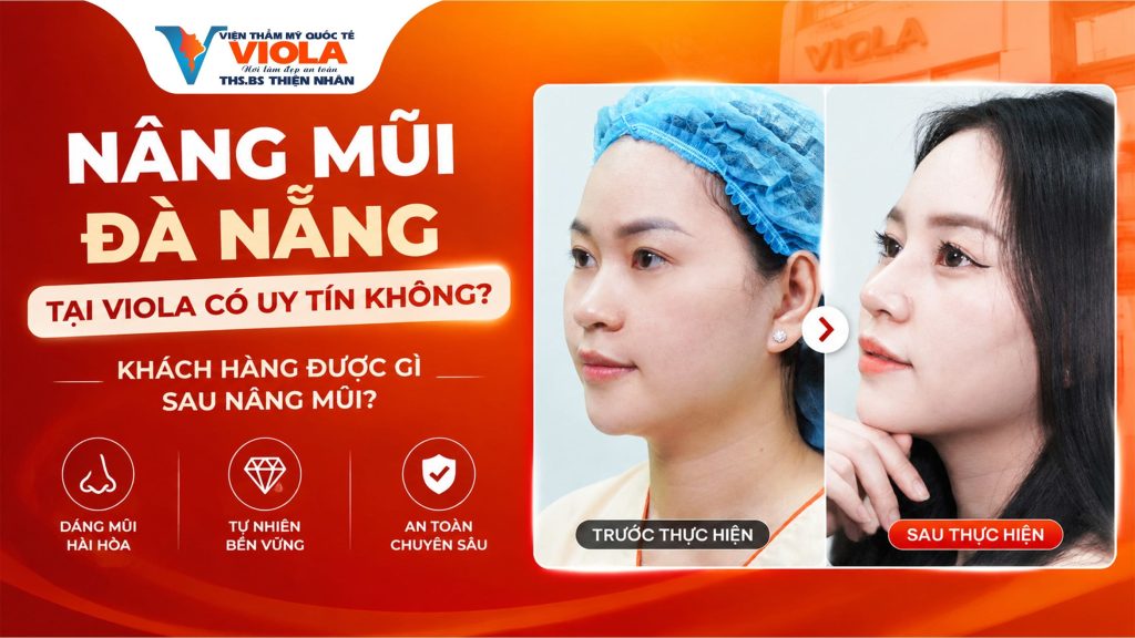 Nâng mũi Đà Nẵng tại Viola có uy tín không? Khách hàng được gì sau nâng mũi 1 nang mui da nang tai viola co uy tin khong khach hang duoc gi sau nang mui