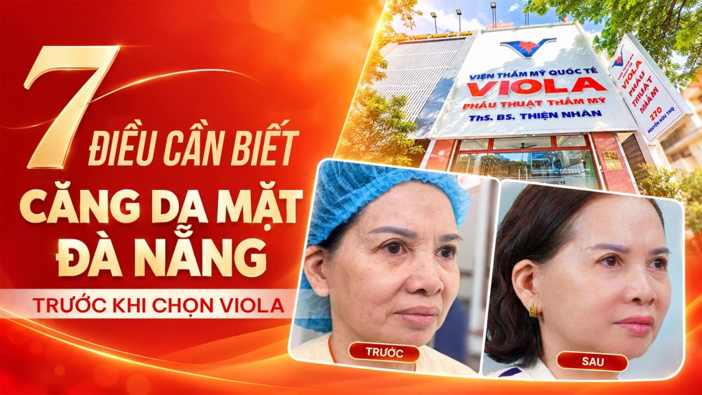 7 dieu can biet ve cang da mat da nang truoc khi chon viola