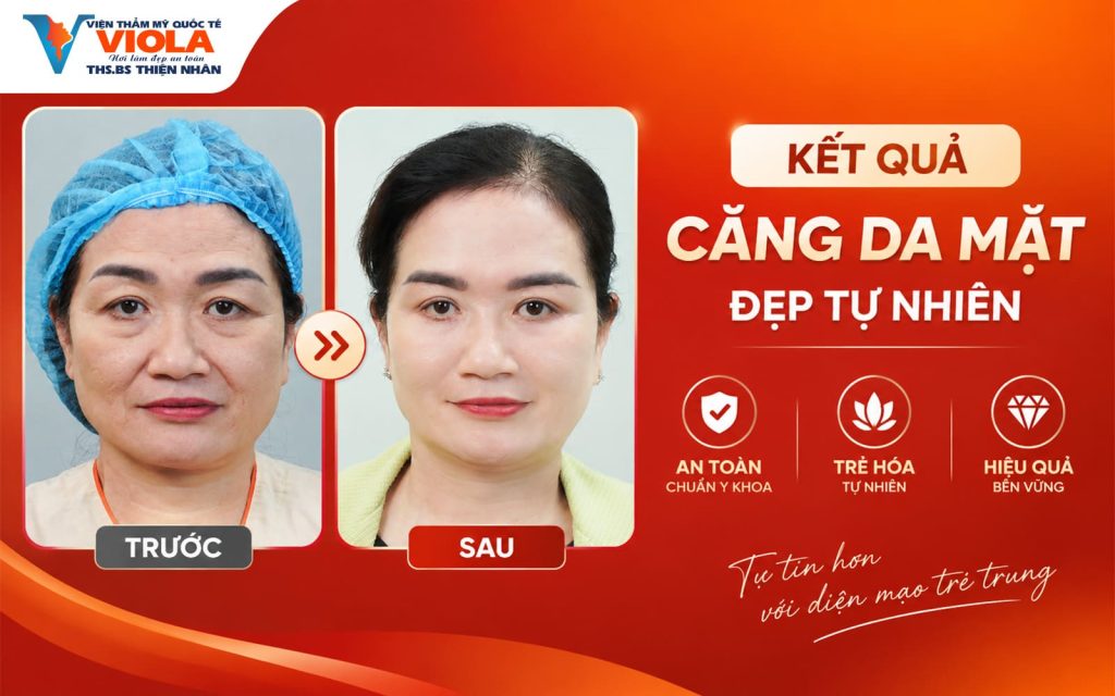ket-qua-cang-da-mat-dep-tu-nhien